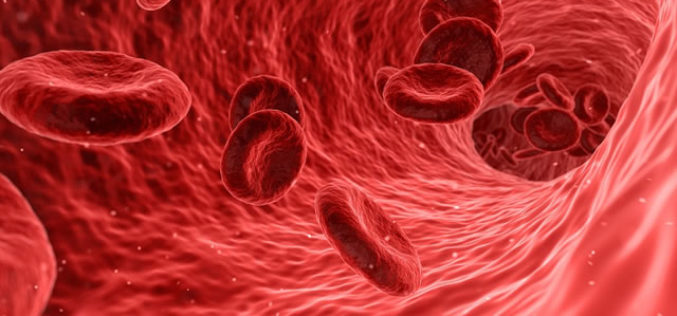 Is Endovascular Surgery The Medical Path For You?