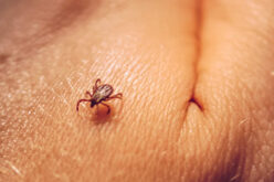 How to Stay Away From a Tick Bite